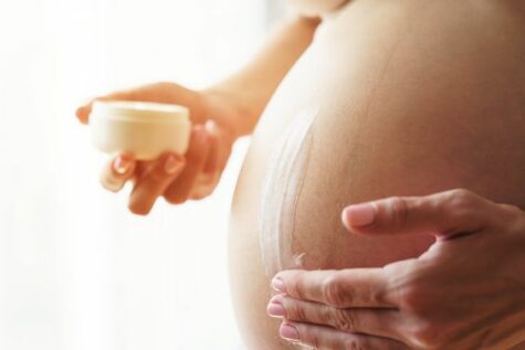 5 STRETCH MARK CREAM