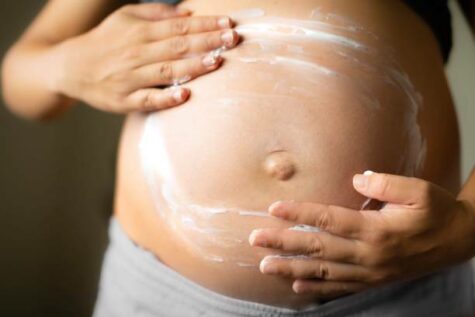 5 STRETCH MARKS