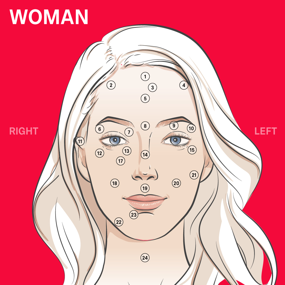 24_Moles_on_women_face